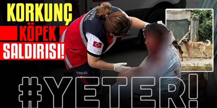Ataşehir’de köpek saldırdı: Kadın ağır yaralandı!