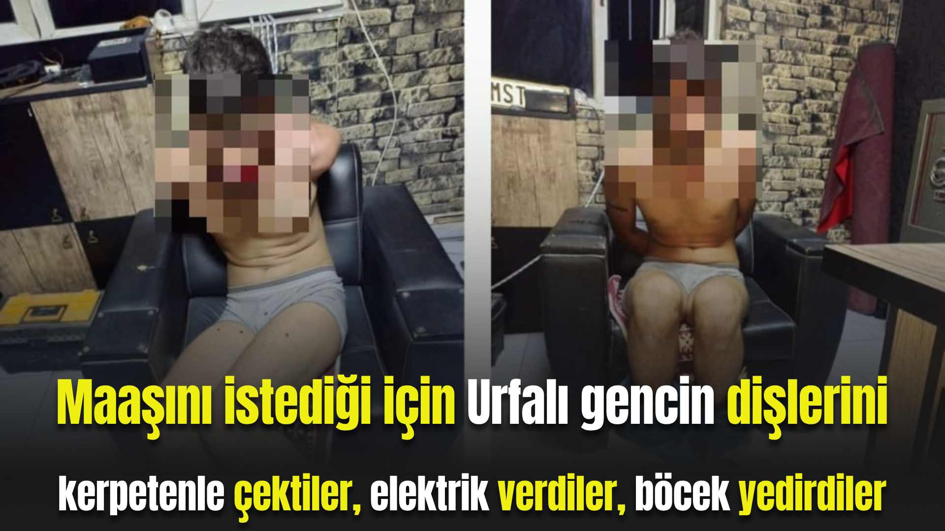 Maaşını Istediği Için Urfalı Gencin Dişlerini Kerpeten Ile Çektiler, Böcek Yedirdiler, Elektrik Verdiler...