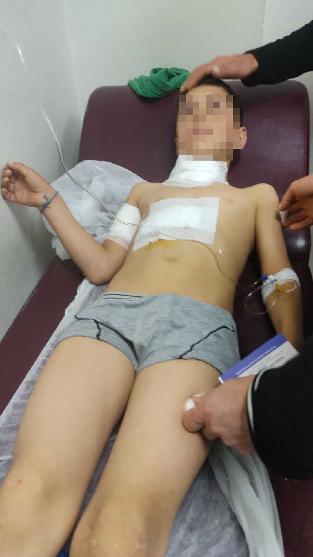 Diyarbakır’da 10 Yaşındaki Ahmet, Köpek Saldırısında Yaralandı 1