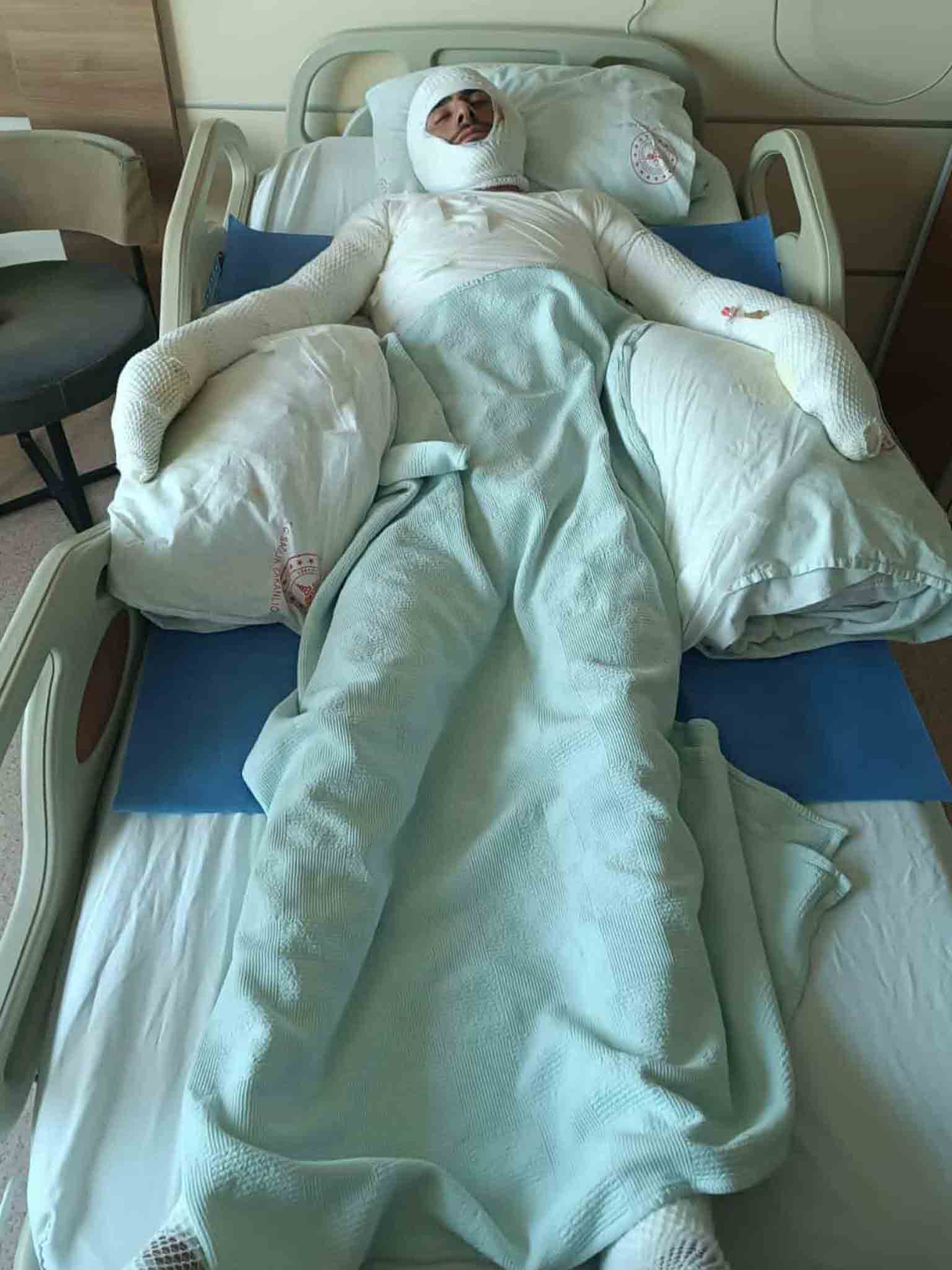 Bin Dönüm Buğday Tarlası Yandı, 1'I Ağır 5 Kişi Yaralandı 4