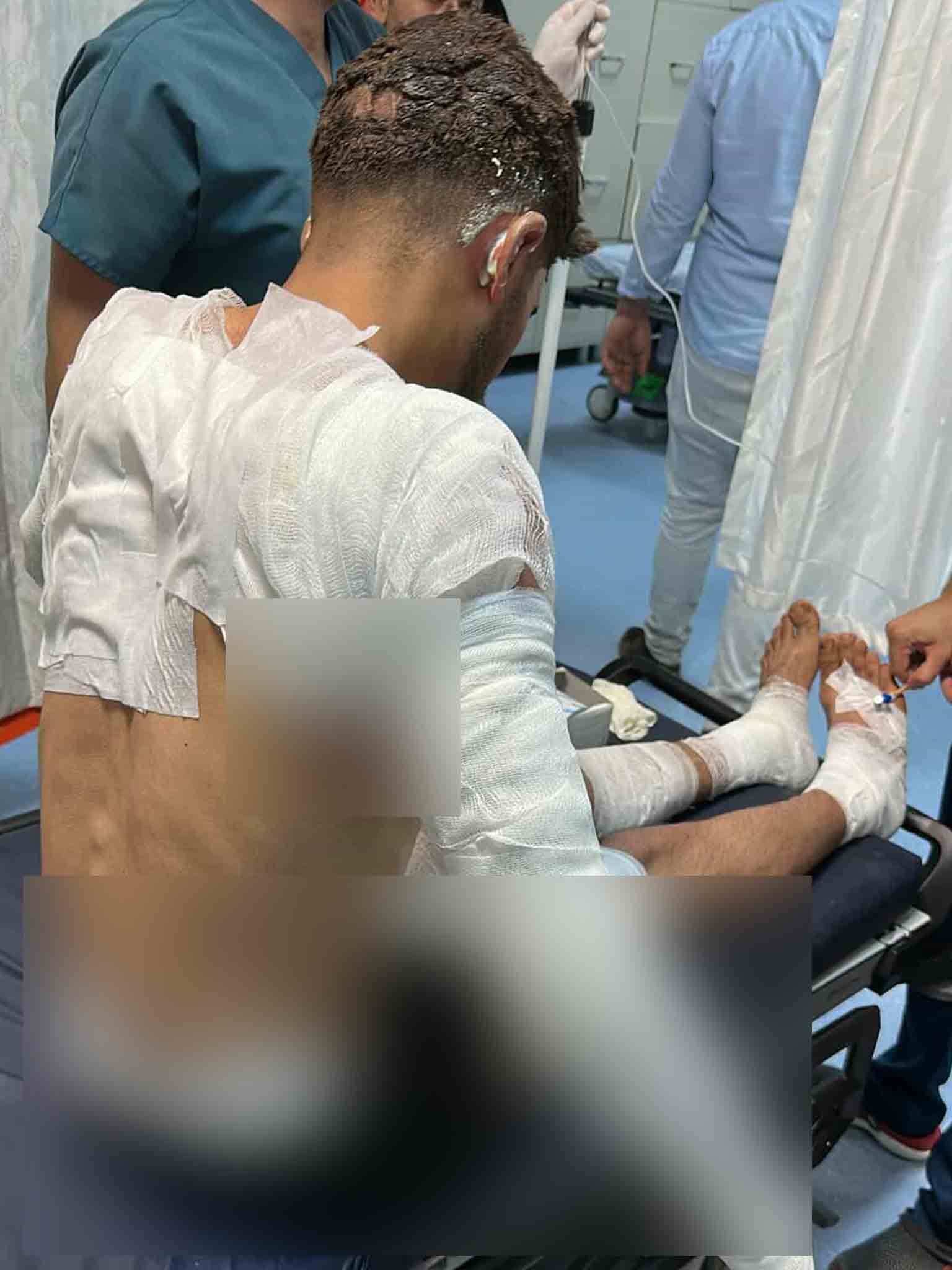 Bin Dönüm Buğday Tarlası Yandı, 1'I Ağır 5 Kişi Yaralandı 5