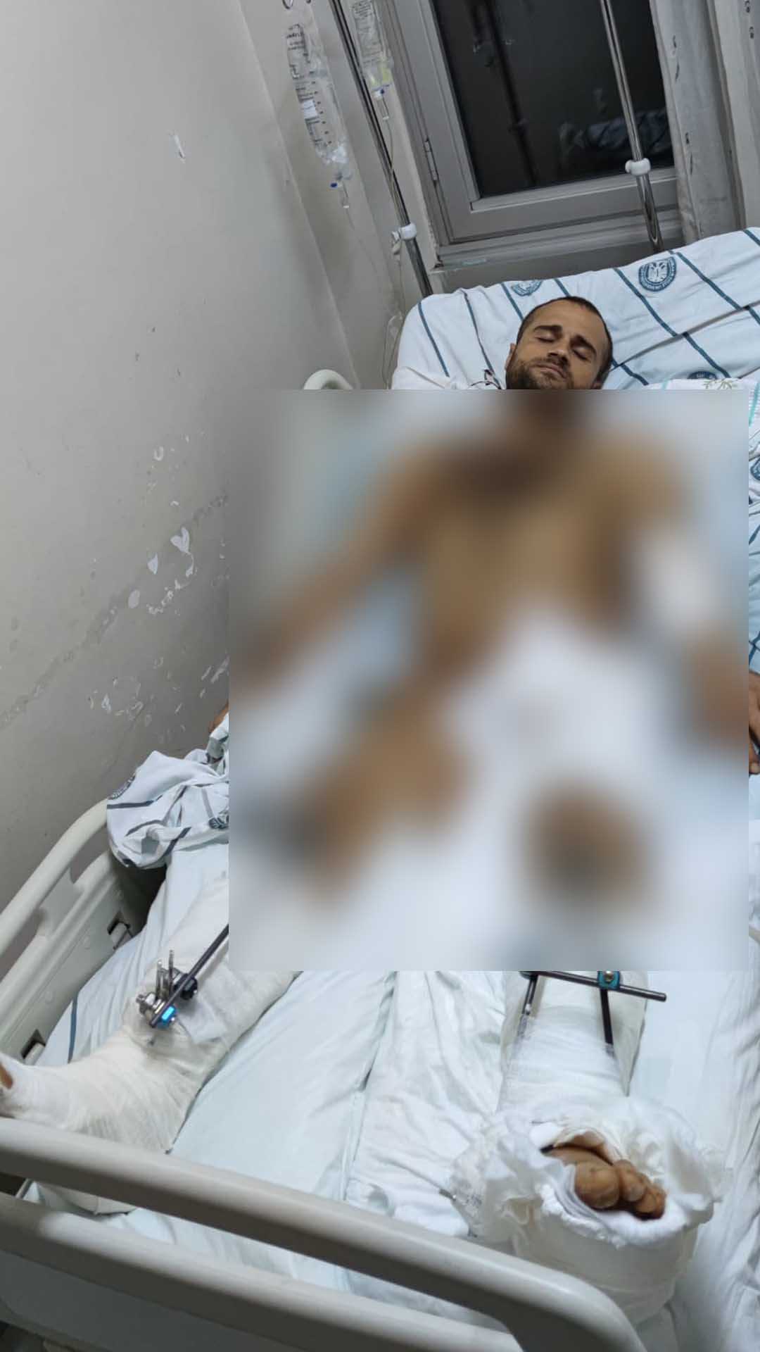 Silahlı Kavgada Bacağı Koptu, Yakınları Adalet Istiyor 8