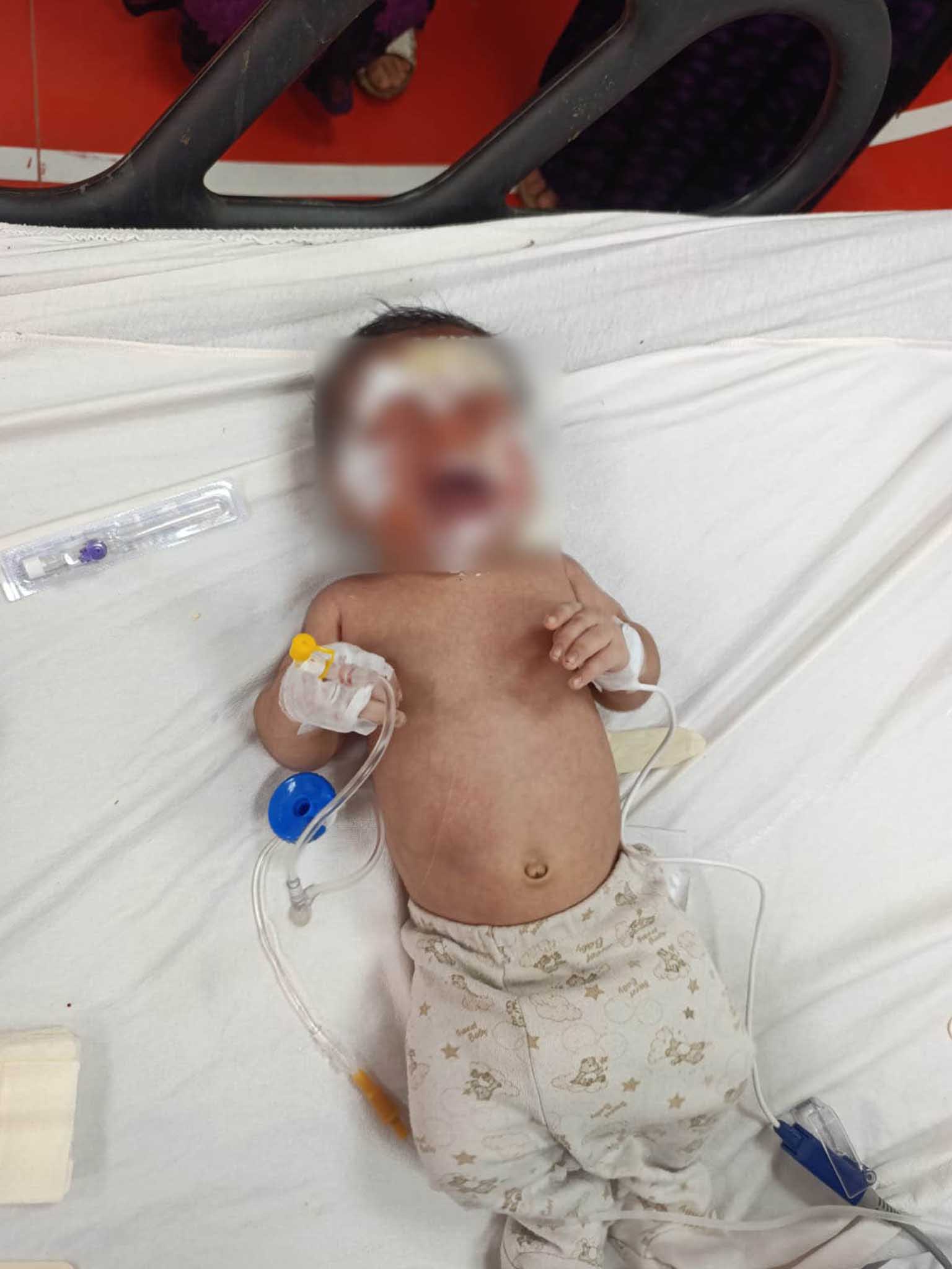 Evleri Defalarca Yandı, Sığındıkları Ev De Yandı 7