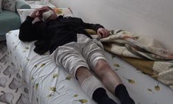 Bir sokak köpeği dehşeti daha! Muş'ta burun, dudak ve bacağından yaralanan kişi hastaneye kaldırıldı