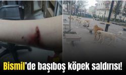 Bismil’de köpek saldırısına uğrayan genç kız yaralandı