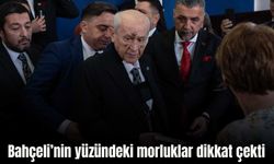 Devlet Bahçeli oyunu kullandı: Yüzündeki morluklar dikkat çekti