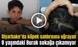 Diyarbakır’da köpek saldırısına uğrayıp başına 37 dikiş atılan 8 yaşındaki Burak sokağa çıkamıyor