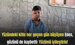 Yüzündeki kitle her geçen gün büyüyen Enes, gözünü de kaybetti: Yüzümü iyileştirin!