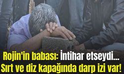 Rojin'in babası: Sırt ve diz kapağında darp izi var!