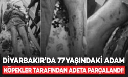 Diyarbakır’da 77 yaşındaki Alzheimer hastası köpekler tarafından adeta parçalandı!