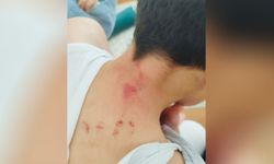 10 yaşındaki öğrencisini darp eden öğretmen tutuklandı: Valilikten açıklama