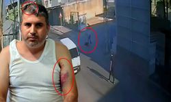 "Doğu adetinde kadına miras yok" dedi, yeğenini beyzbol sopasıyla dövdü