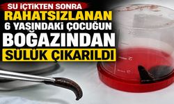Su İçtikten Sonra Rahatsızlanan 6 Yaşındaki Çocuğun Boğazından Sülük Çıkarıldı