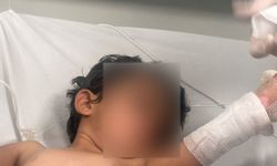 Kaynar Su Dolu Kazan Devrildi, 3 Yaşındaki Çocuk Yaralandı