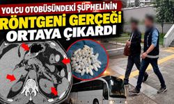 Yolcu otobüsündeki şüphelinin röntgeni gerçeği ortaya çıkardı