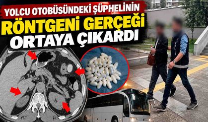 Yolcu otobüsündeki şüphelinin röntgeni gerçeği ortaya çıkardı