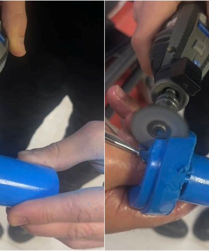 Parmağa Sıkışan Plastik Parça Ekipleri Harekete Geçirdi