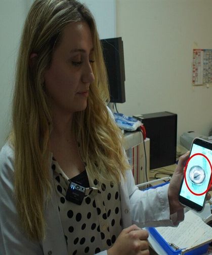 Sürekli Burun Kanaması Şikayetiyle Gitti, Boğazından Canlı Sülük Çıktı!