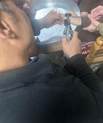 Parmağındaki yüzük sıkıştı, yardımına itfaiye yetişti
