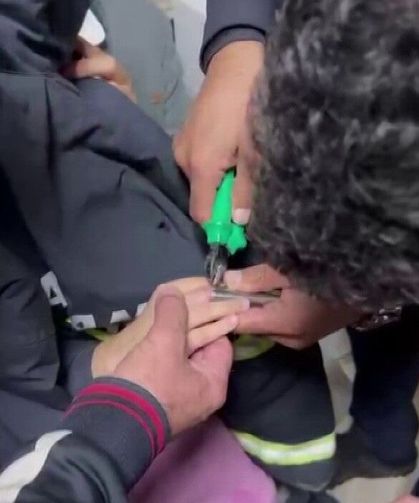 Oyun oynarken parmağını boruya sıkıştıran küçük kız ekiplerce kurtarıldı