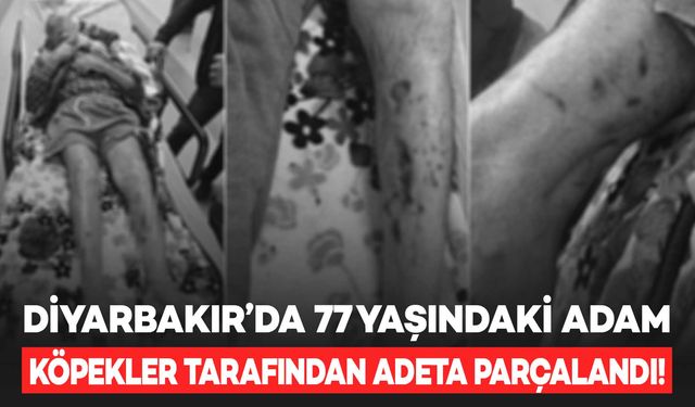 Diyarbakır’da 77 yaşındaki Alzheimer hastası köpekler tarafından adeta parçalandı!