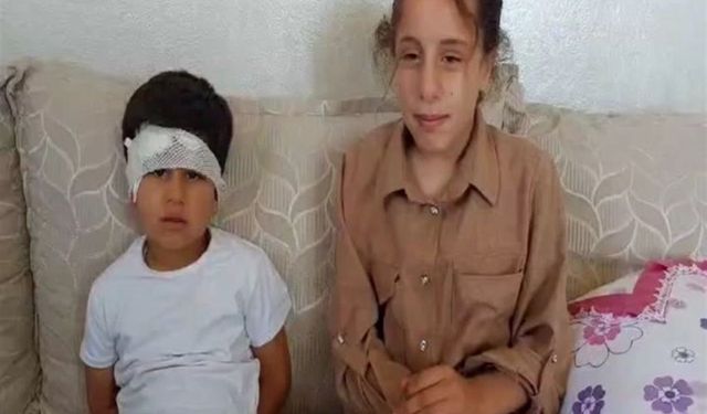 Köpek Saldırısına Uğrayan Çocuğun Ablası O Anları Anlattı: "Babam ve Amcam Yetişip Kurtardı"