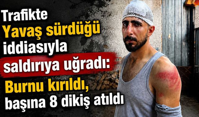 Yavaş sürdüğü iddiasıyla saldırıya uğradı: Burnu kırıldı, başına 8 dikiş atıldı