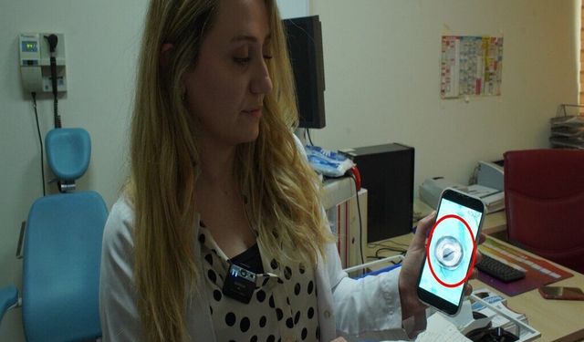Sürekli Burun Kanaması Şikayetiyle Gitti, Boğazından Canlı Sülük Çıktı!
