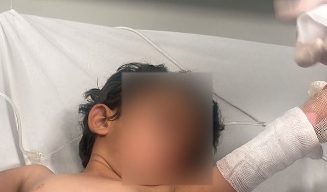 Kaynar Su Dolu Kazan Devrildi, 3 Yaşındaki Çocuk Yaralandı
