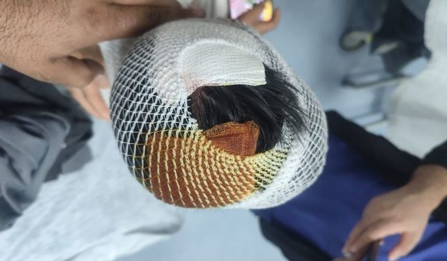 Köpek saldırısına uğrayan 8 yaşındaki öğrencinin başına 15 dikiş atıldı