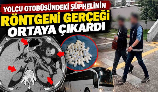 Yolcu otobüsündeki şüphelinin röntgeni gerçeği ortaya çıkardı