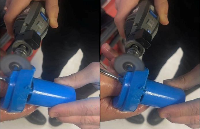 Parmağa Sıkışan Plastik Parça Ekipleri Harekete Geçirdi