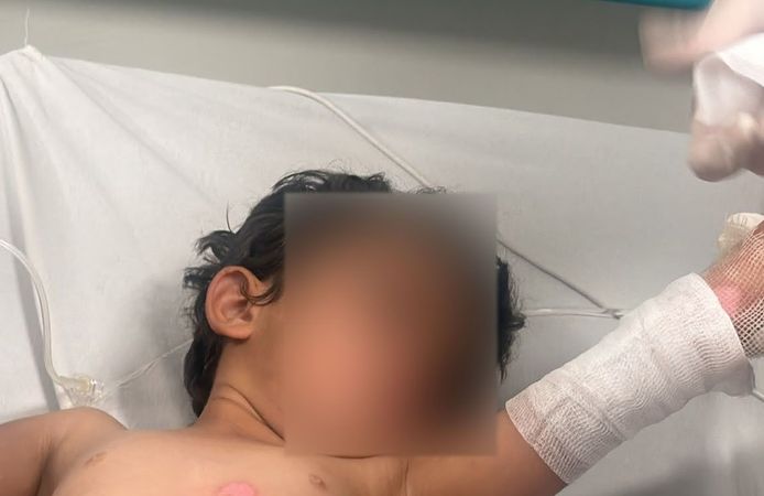 Kaynar Su Dolu Kazan Devrildi, 3 Yaşındaki Çocuk Yaralandı