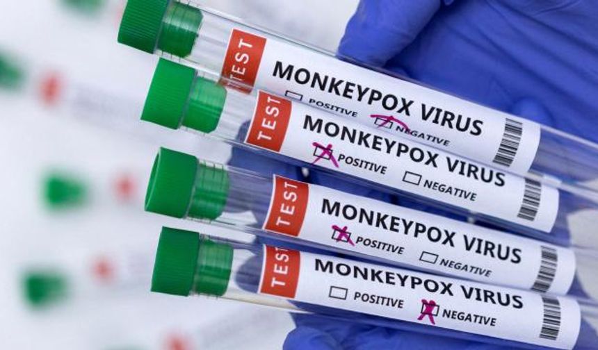 ABD’de Mpox’un Yeni Varyantı İlk Kez Görüldü