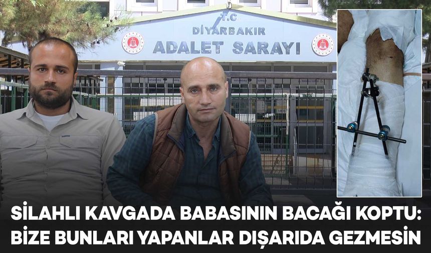 DİYARBAKIR-Silahlı kavgada bacağı koptu, yakınları adalet istiyor